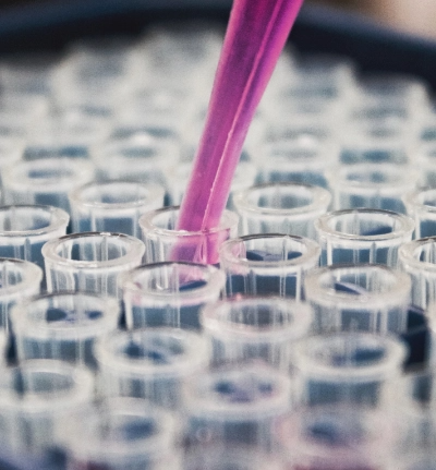 Reagenzgläser und gefüllte Pipette für die Untersuchung von Lysosomalen Speicherkrankheiten