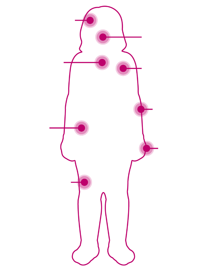 Symptomen divers en progressief