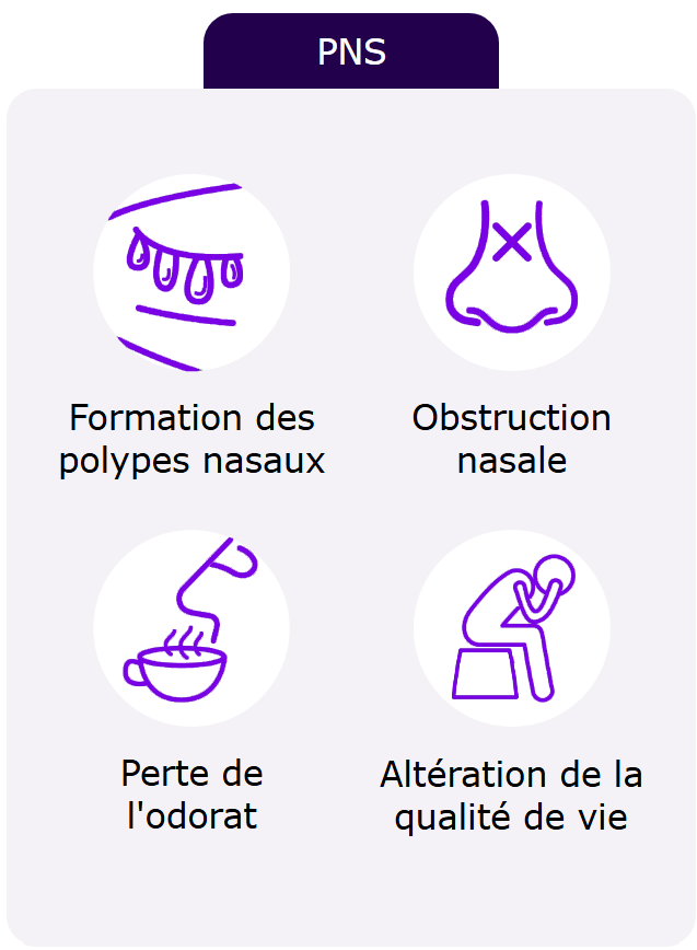 PNS - Formation des polypes nasaux ; Obstruction nasale ; Perte de l'odorat ; Altération de la qualité de vie.