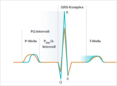 Infografik zeigt ein EKG mit markierten Abschnitten: P-Welle, PQ-Intervall, PEND Q-Intervall, QRS-Komplex mit R, Q und S, sowie T-Welle.