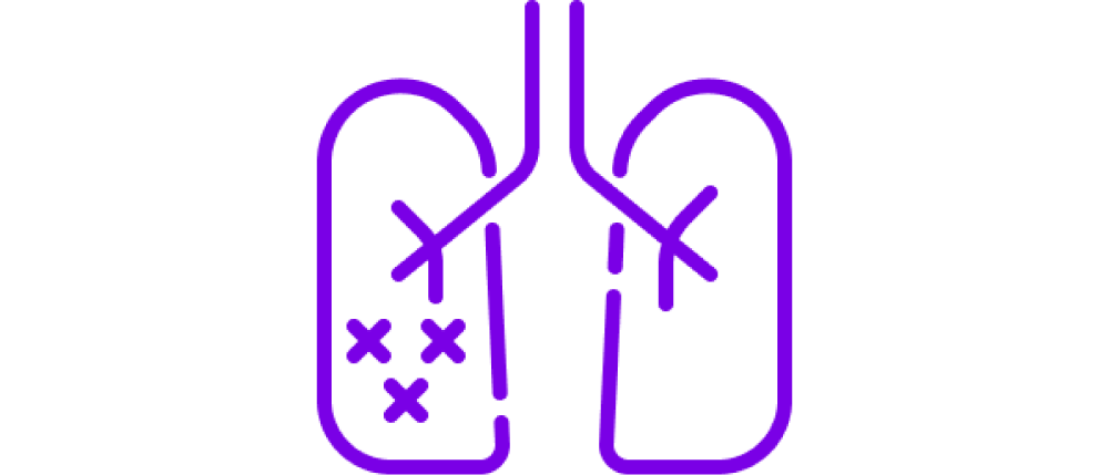 asthme