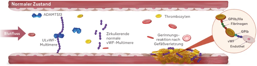 Medizinische Illustration eines Blutgefäßes in der eine physiologische Gerinnungsreaktion nach einer Gefäßverletzung dargestellt wird, bei der Thrombozyten die Gefäßwand verschließen.