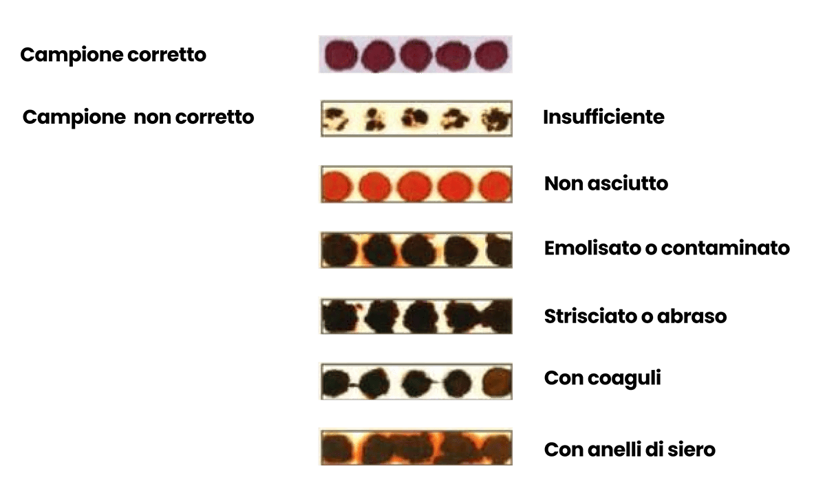compressed image size