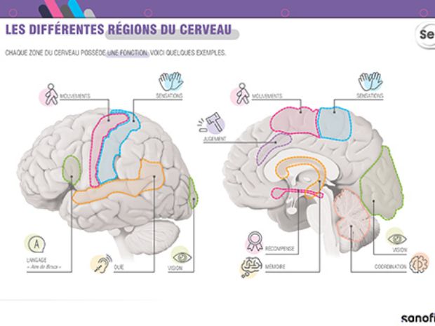 Planche didactique IDE pour expliquer les différentes zones du cerveau, la fatigue, les douleurs, et le phénomène d’Uhthoff e