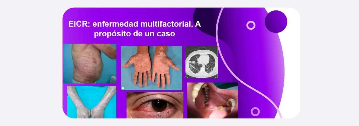 proposito-de-un-caso