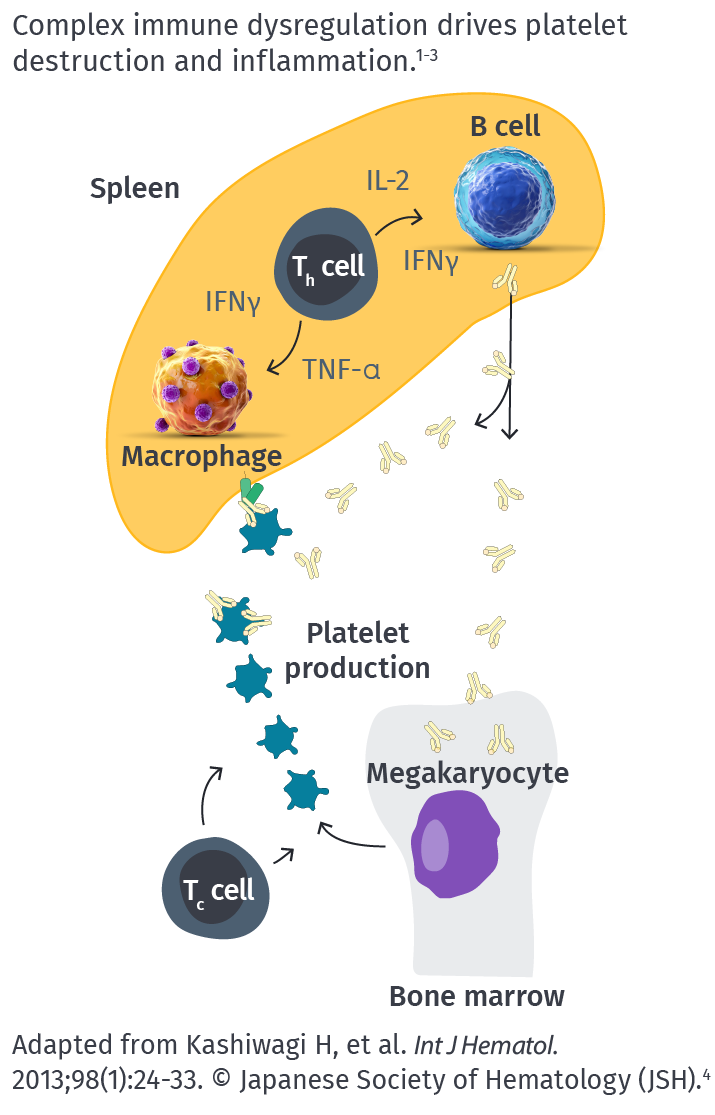 Complex immune dysregulation in immune thrombocytopenia (ITP) can lead to platelet destruction and inflammation.