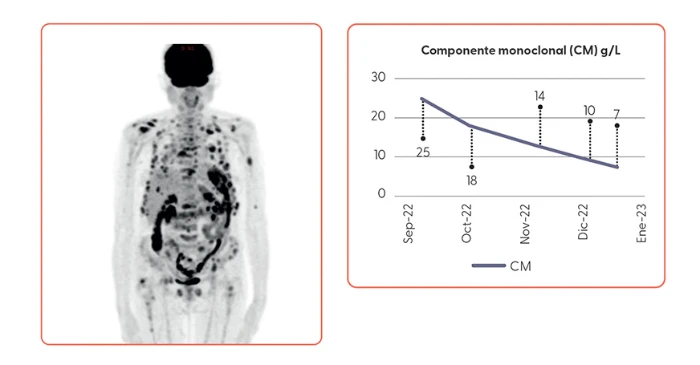 eficacia-tratamiento-isatuximab-carfilzomib-dexametasona-segunda-linea-figura-6-7
