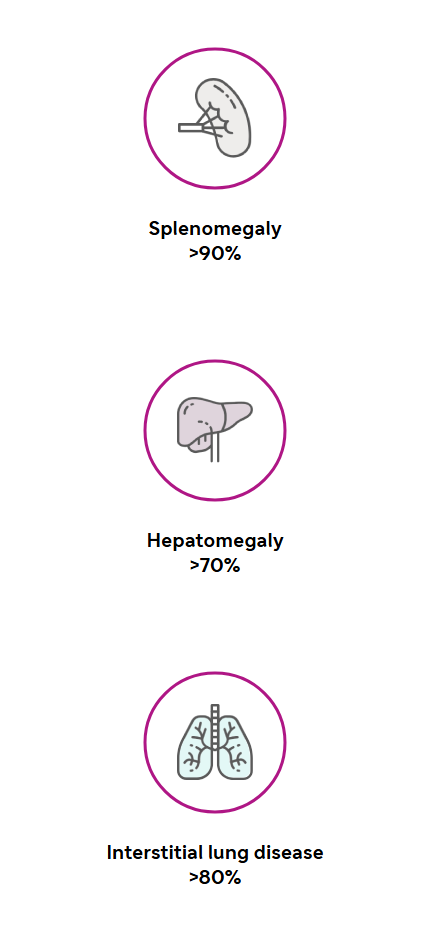 Icons of depicting splenomegaly >90%; hepatomegaly >70%; interstitial lung disease >80%.