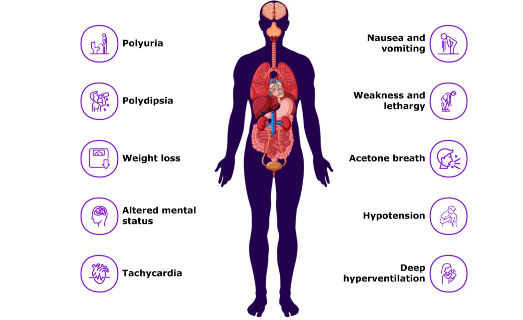 Symptoms-DKA
