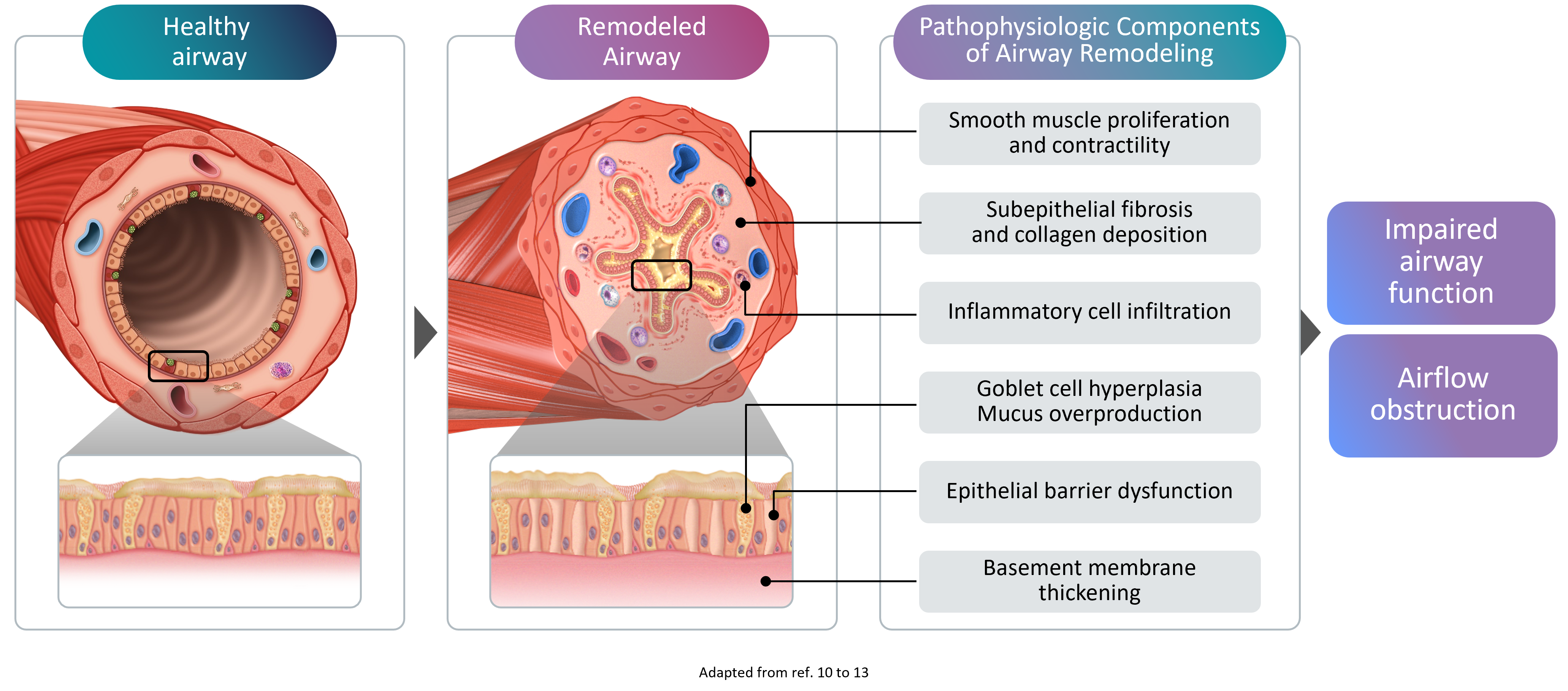 Remodeling in asthma