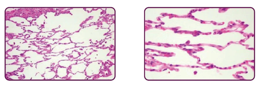 alveoli