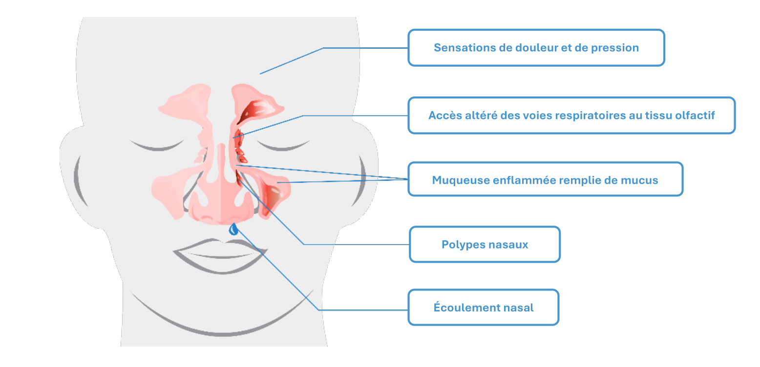 Modifications inflammatoires