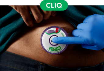 Action shot of activating CirCLIQ on abdomen.