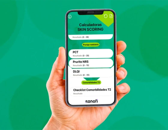 imagen calculadora skinscore
