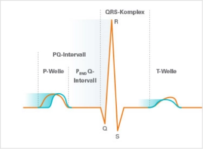 Infografik zeigt ein EKG mit markierten Abschnitten: P-Welle, PQ-Intervall, QRS-Komplex mit R, Q, S, und T-Welle.
