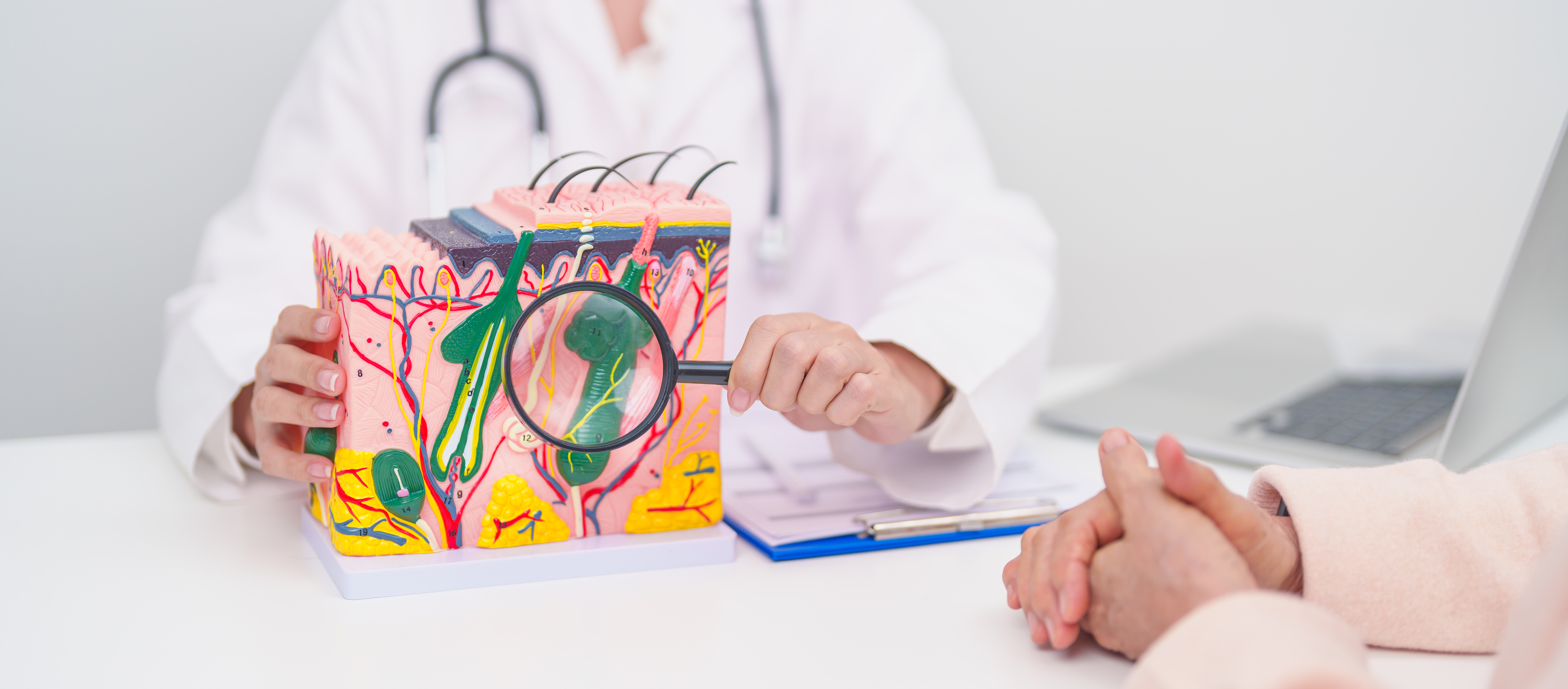 Arzt hält ein farbiges 3D-Modell der Haut mit vergrößerter Darstellung von Hautschichten und Haarfollikeln vor einem Patienten