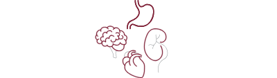 ischemia figure
