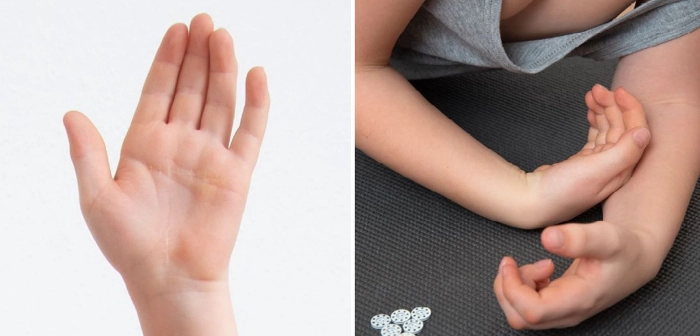 Links eine offene Hand mit gespreizten Fingern, rechts zwei verschränkte Arme mit gebeugten Handgelenken auf dunklem Untergrund.