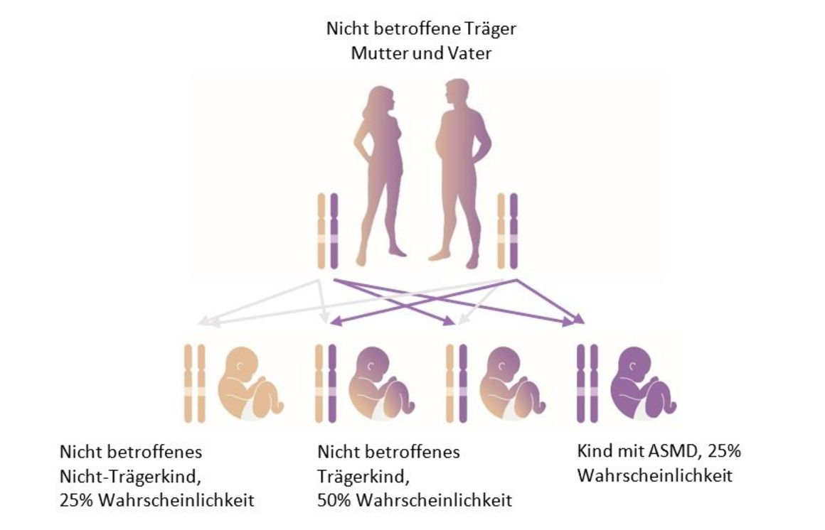 Grafik zeigt Vererbung mit Mutter und Vater, jeweils mit zwei Chromosomenpaaren, und drei Babys mit unterschiedlicher Wahrscheinlichkeit für ASMD