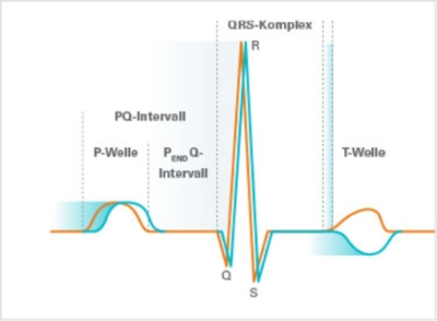 Infografik zeigt zwei überlagerte EKG-Kurven mit Beschriftungen der Abschnitte P-Welle, PQ-Intervall, QRS-Komplex und T-Welle.