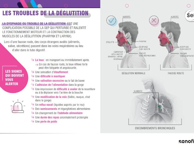 Troubles de la parole et déglutition