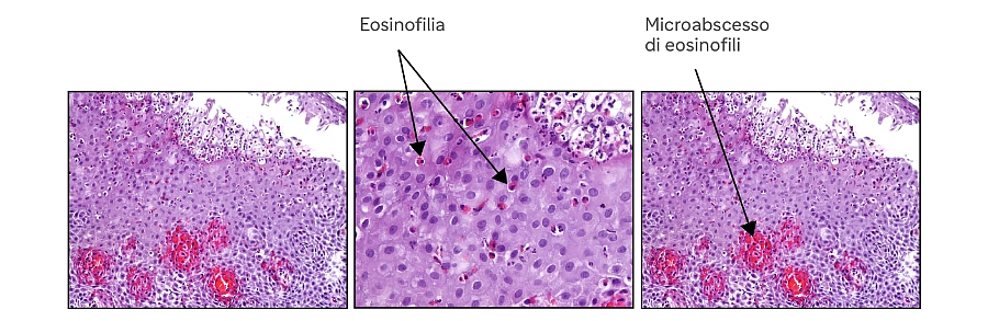 Sanofi_EoE-13