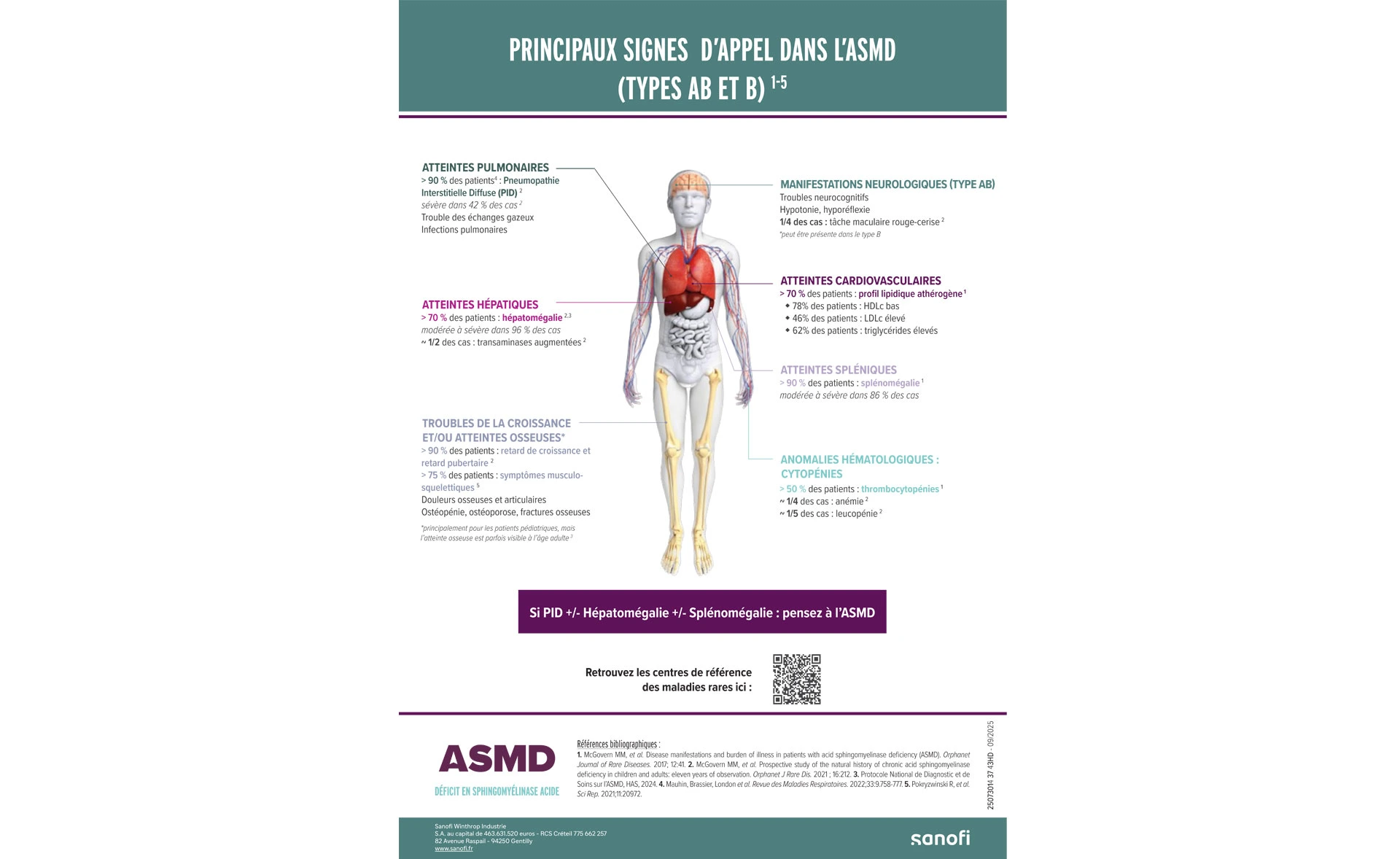 Infographie des principaux signes d'appel de l'ASMD selon les organes atteints.