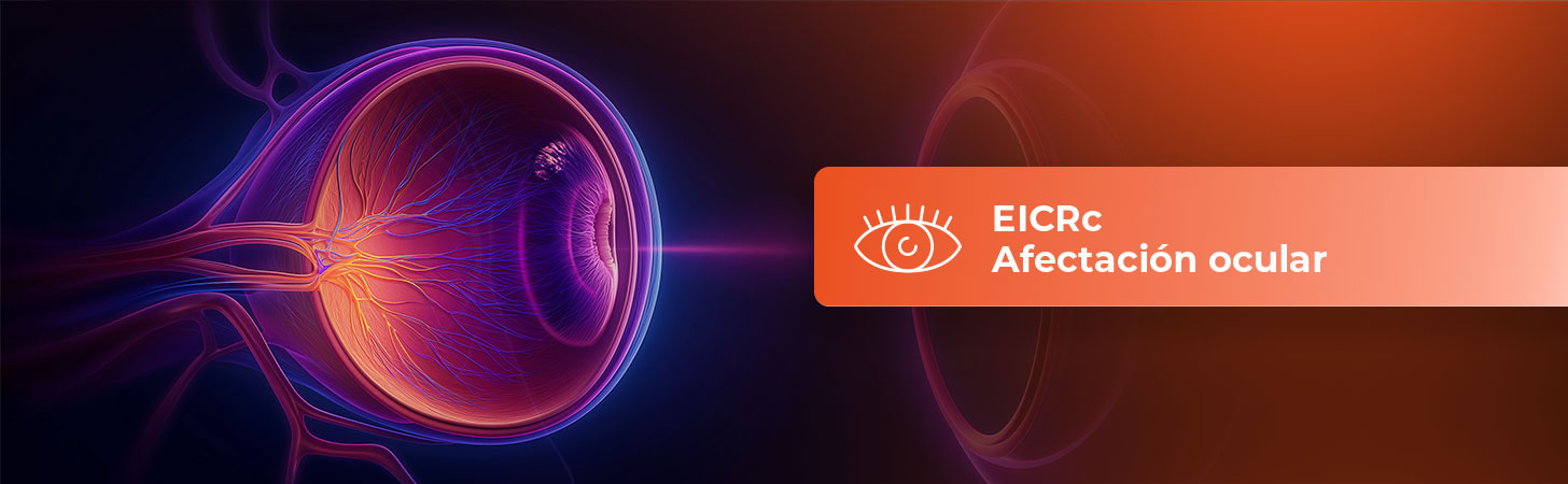 eicr-afectacion-ocular-hb