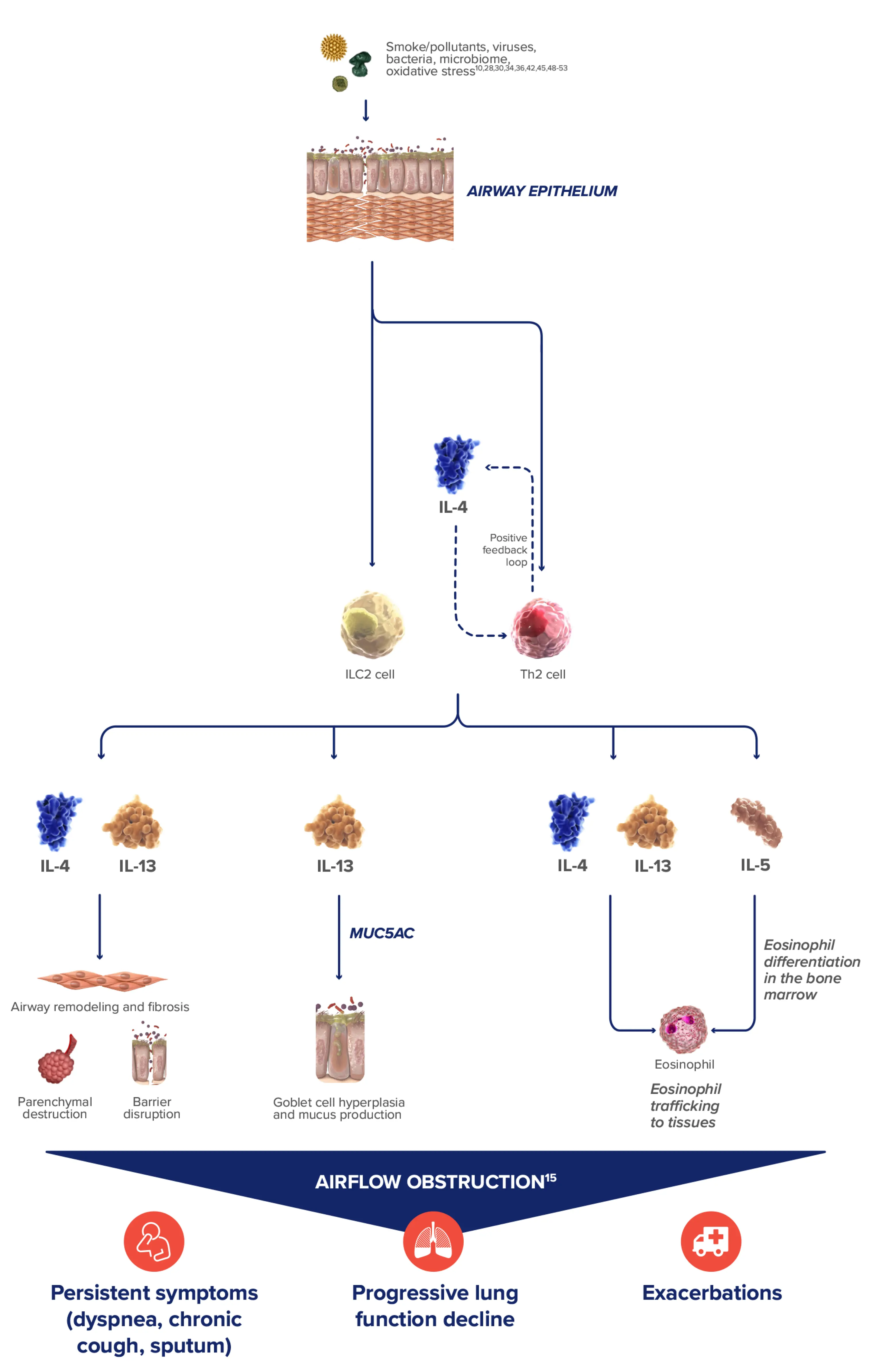 Illustration of the causes of the  airflow obstruction