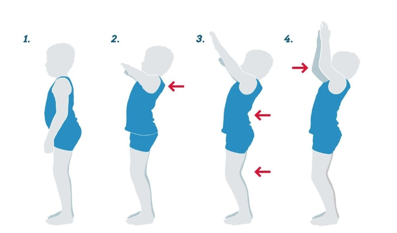 Grafik zeigt in 4 Schritten den Hands-Up-Test zur Prüfung der Schulterbeweglichkeit