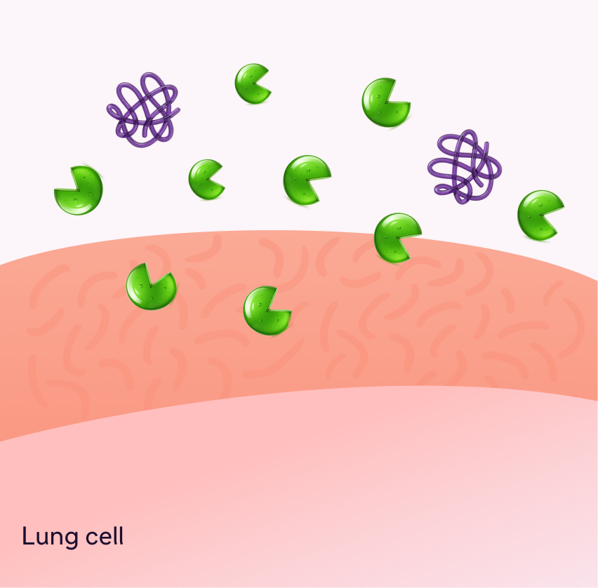 Illustration of AAT protein and elastase imbalance in AATD