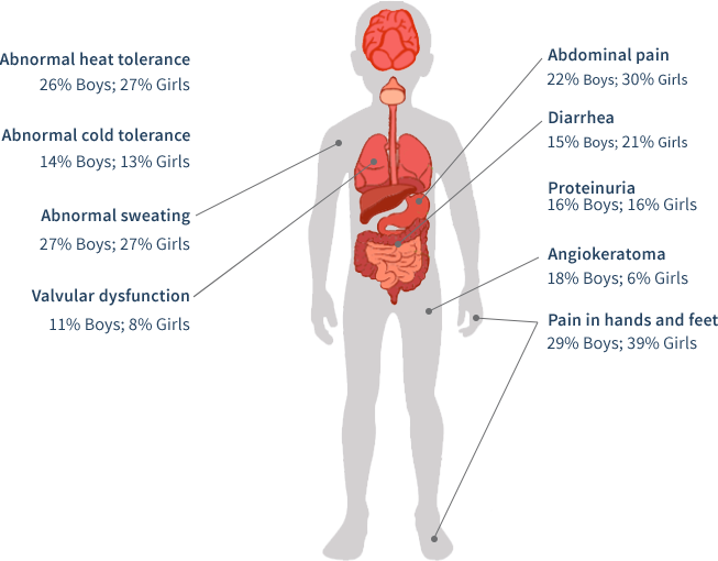 Illustration of where Fabry disease symptoms may present in the body of a pediatric patient and the occurrence percentage in boys and girls