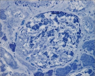 Mikroskopische Aufnahme eines Nierenglomerulus mit blauer Färbung, die Zellstrukturen und Gewebe zeigt.