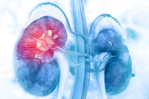 nierfalen-hebben-uw-patienten-altijd-de-juiste diagnose