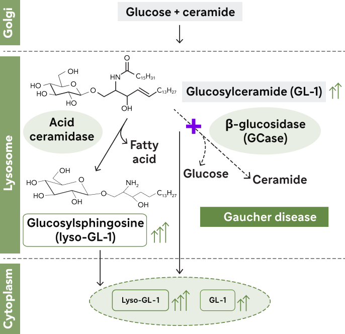 Visual of Gaucher disease pathology