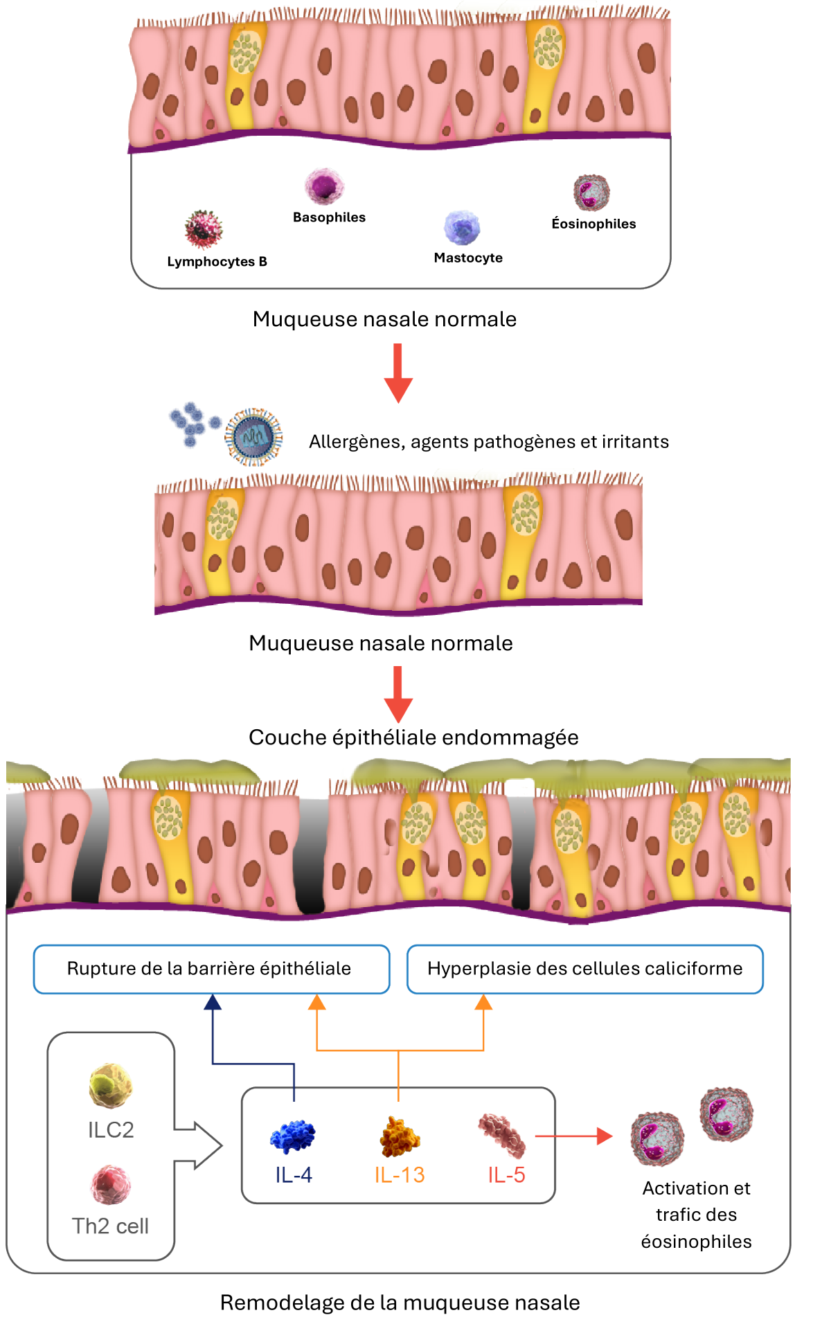 Remodelage epithelial