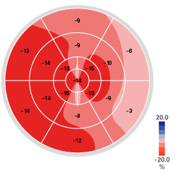 Eine polarplot-Darstellung mit Farbverläufen, die Werte von -20% bis +20% anzeigen.