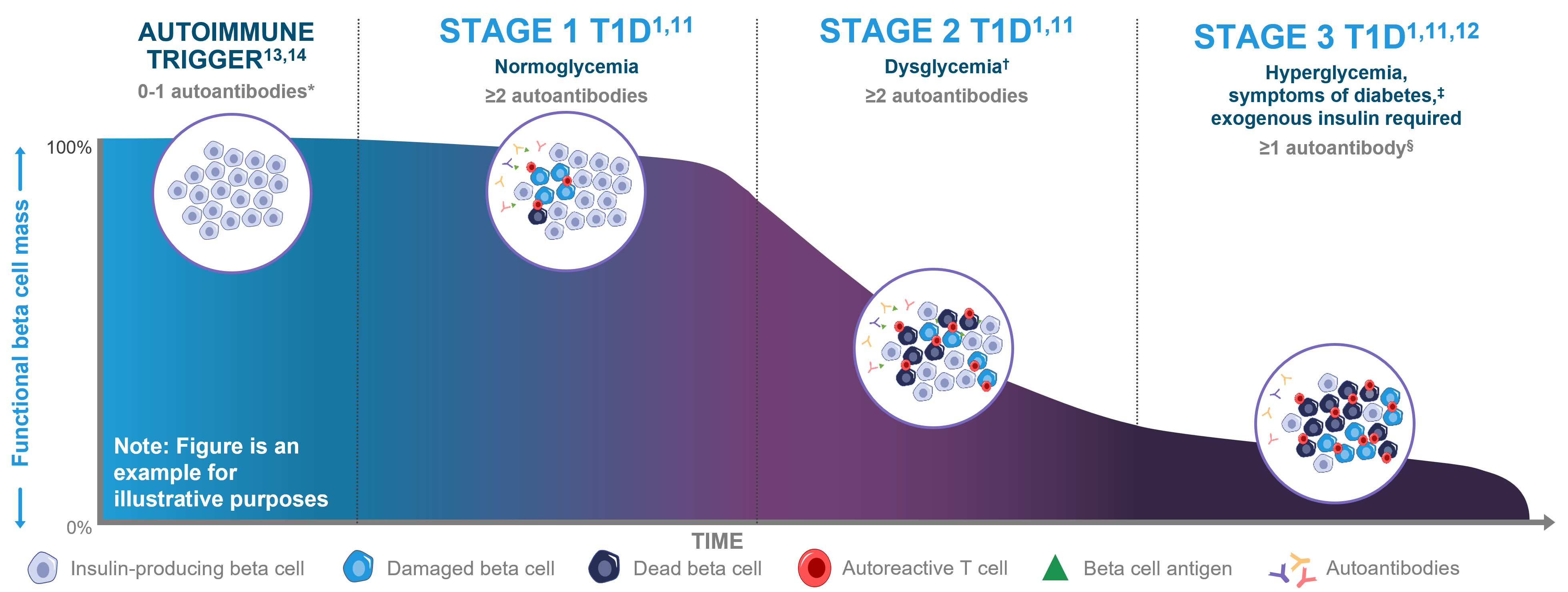stage progression of aT1D