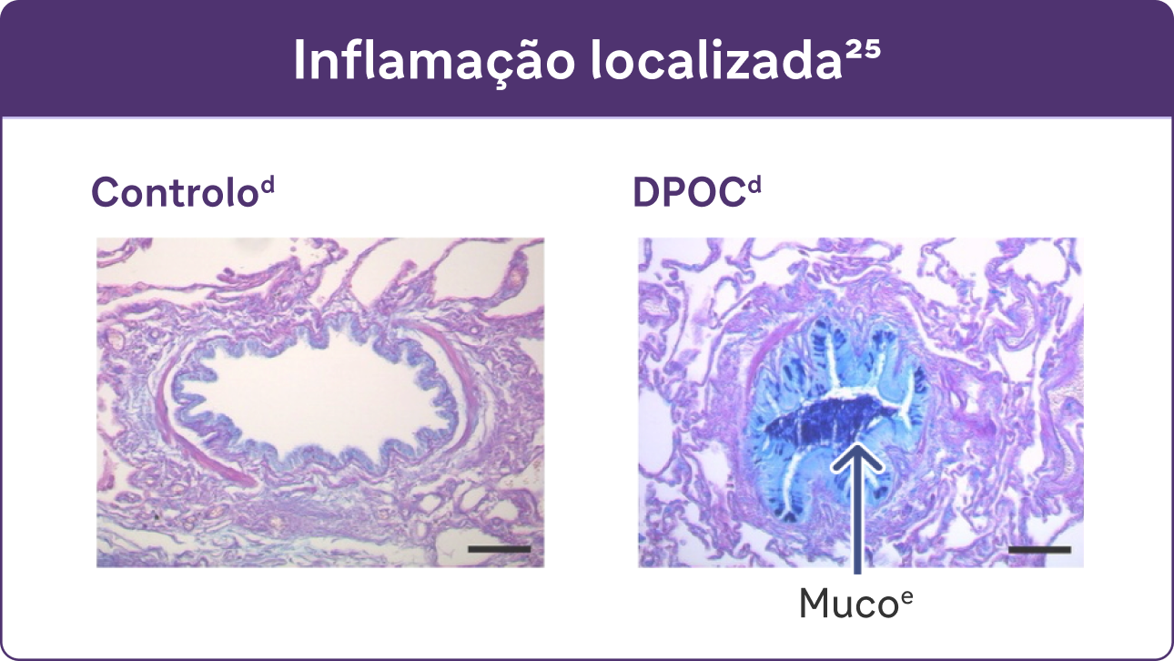 Inflamação localizada