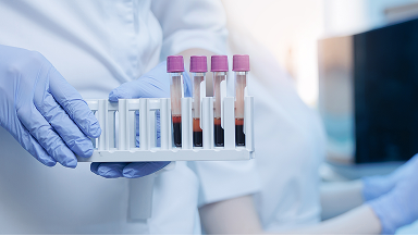 Untersuchung einer Blutprobe im Labor zur Bestimmung von Myelom-Parametern