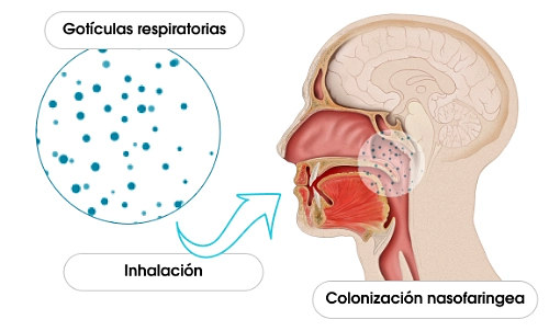 meningo-1-fisiopatologia-01c