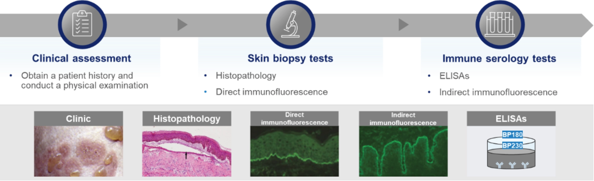 A workflow diagram showing clinical assessment, skin biopsy tests, and immune serology tests used to diagnose bullous pemphigoid, with example images for clinic findings, histopathology, immunofluorescence, and ELISA results.