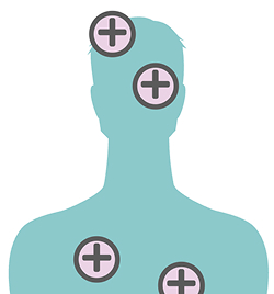 Icon of a person with cross symbols over their body, representing multisystemic ASMD symptoms.