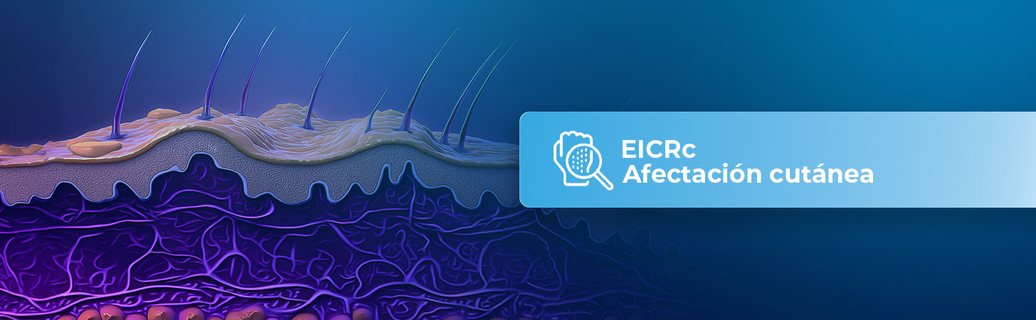 eicr-afectacion-cutanea-hb