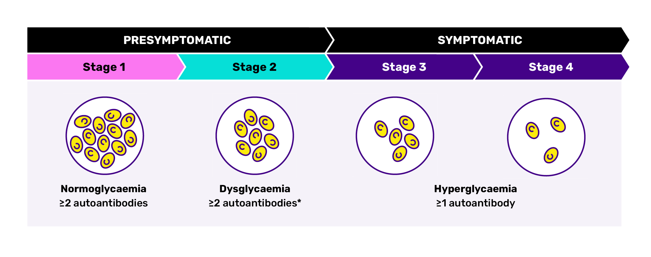 The stages of type 1 diabetes. Stages 1 and 2 are presymptomatic; Stages 3 and 4 are symptomatic. Beta cell levels decrease from Stage 1 to Stage 4.