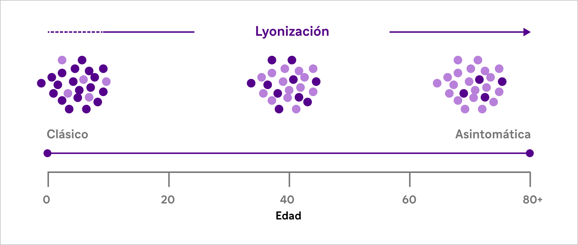 Efecto de la lyonización en mujeres heterocigotas con enfermedad de Fabry: variabilidad del fenotipo, de clásico a asintomático, según la edad