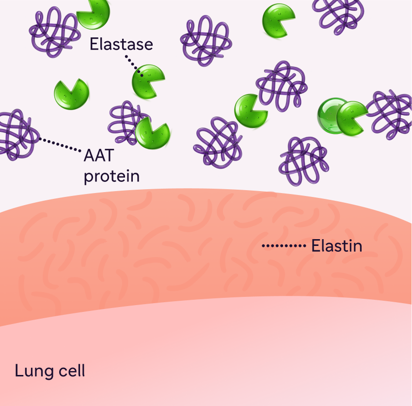 Illustration of healthy AAT protein and elastase balance