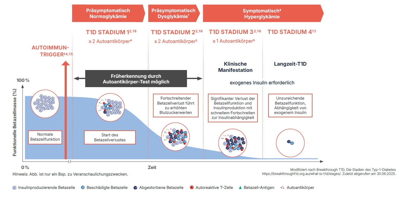 4 Stadien