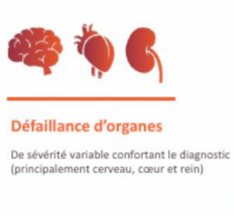 defaillance-d-organes