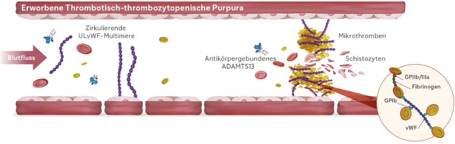 Medizinische Illustration eines Blutgefäßes in der eine physiologische Gerinnungsreaktion nach einer Gefäßverletzung dargestellt wird bei einer aTTP